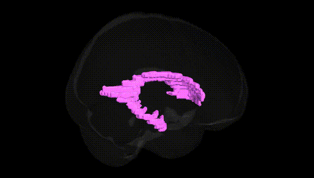 Full Brain Black