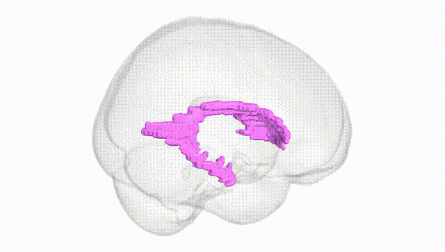 Full Brain White