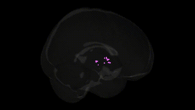 Full Brain Black