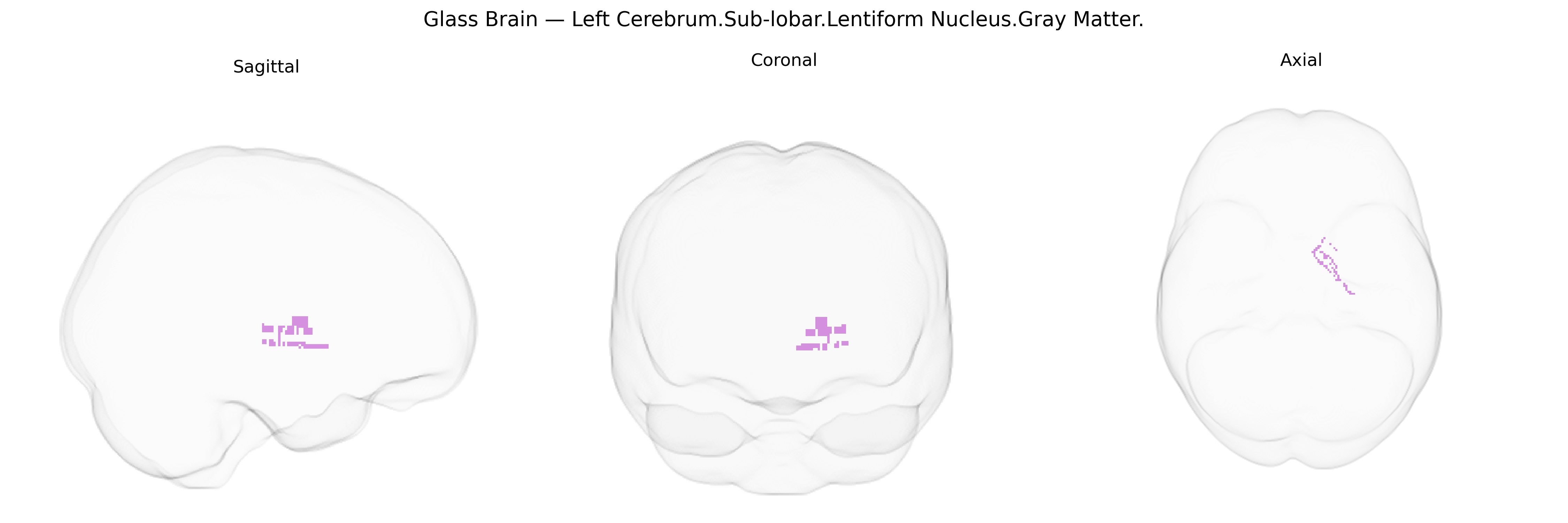 Triplanar Ghost Brain