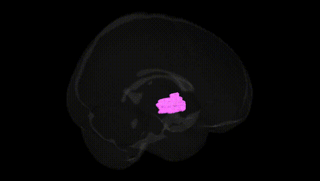 Full Brain Black