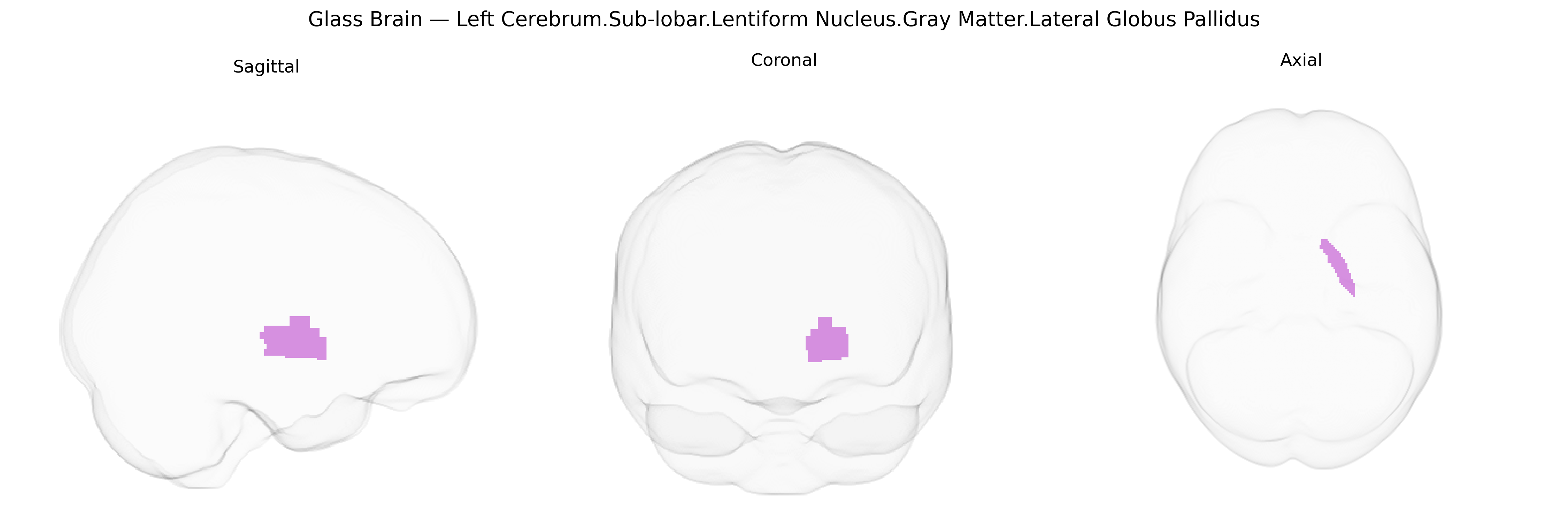 Triplanar Ghost Brain