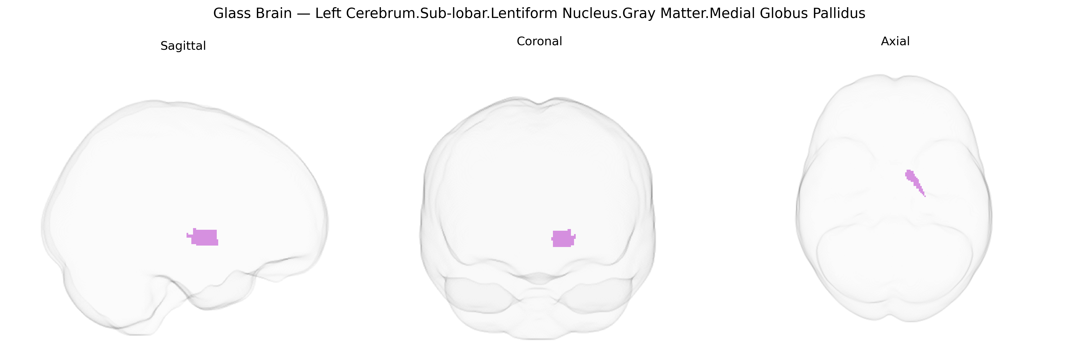 Triplanar Ghost Brain