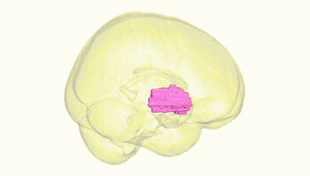 Full Brain White