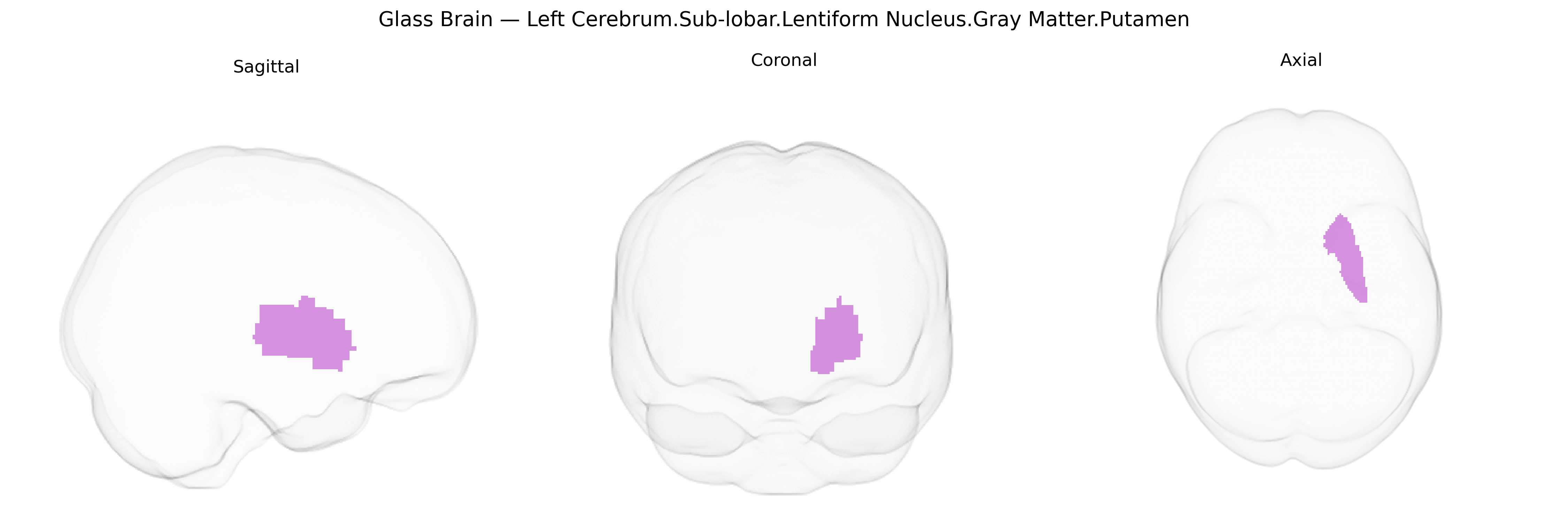 Triplanar Ghost Brain