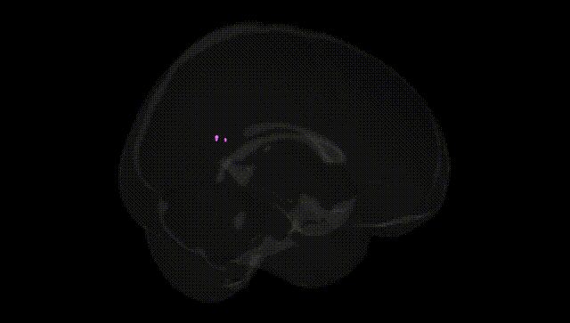 Full Brain Black