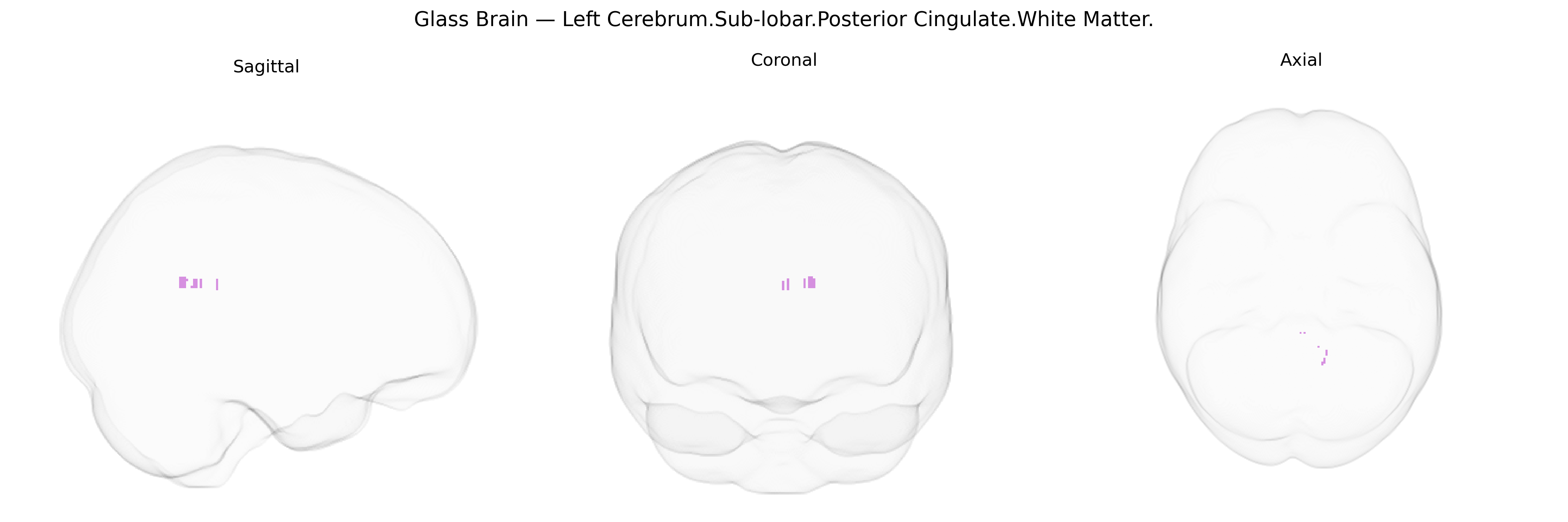 Triplanar Ghost Brain