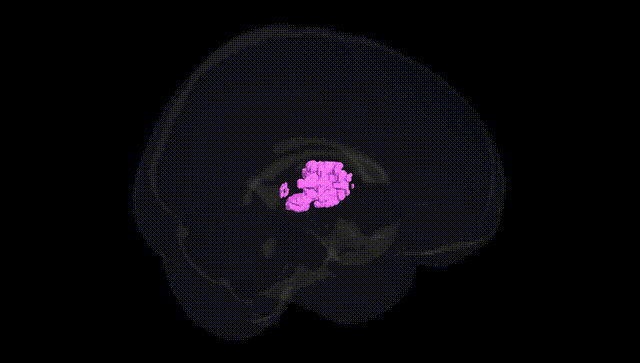 Full Brain Black