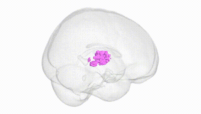 Full Brain White