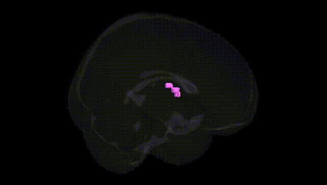 Full Brain Black