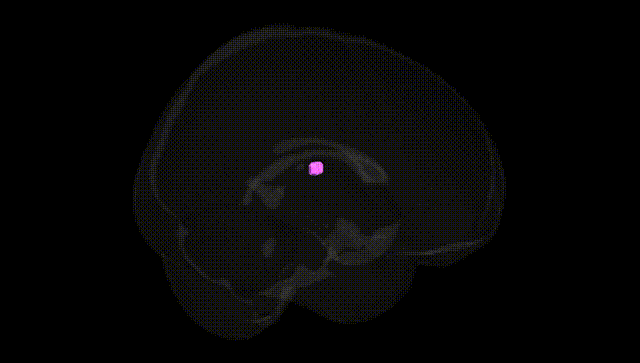 Full Brain Black