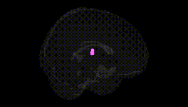 Full Brain Black