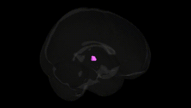 Full Brain Black