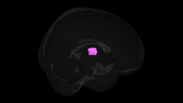 Full Brain Black
