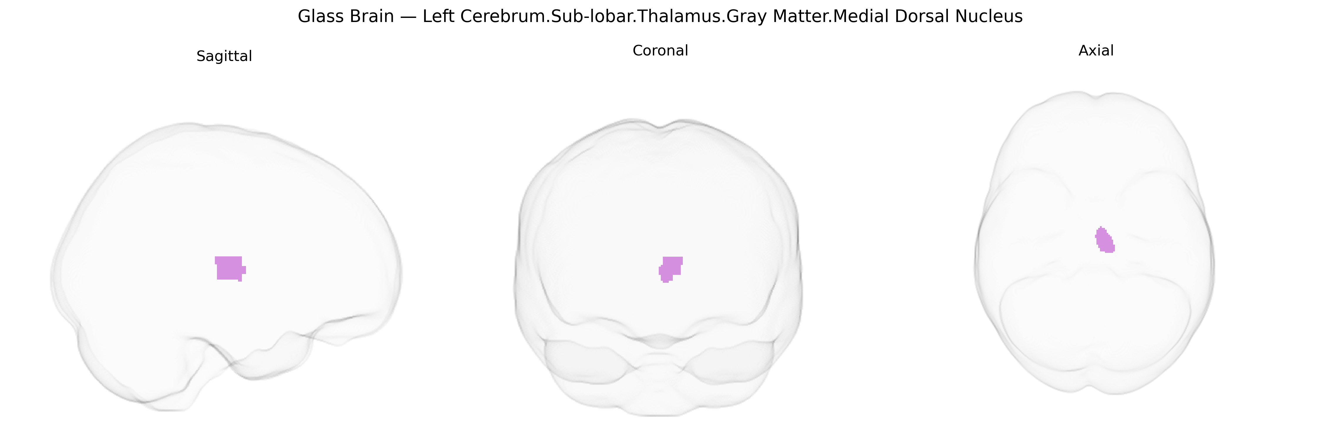 Triplanar Ghost Brain