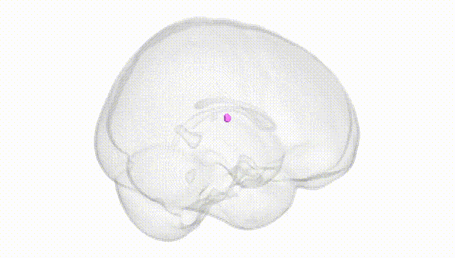 Full Brain White