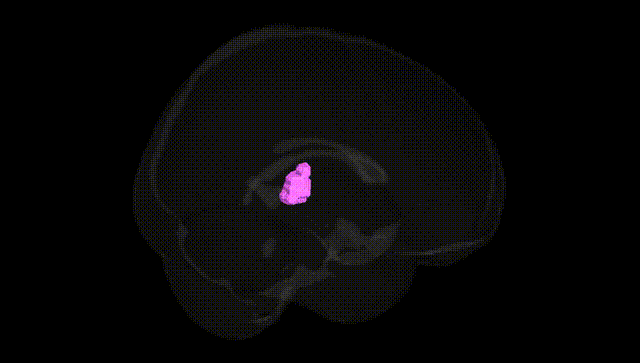 Full Brain Black