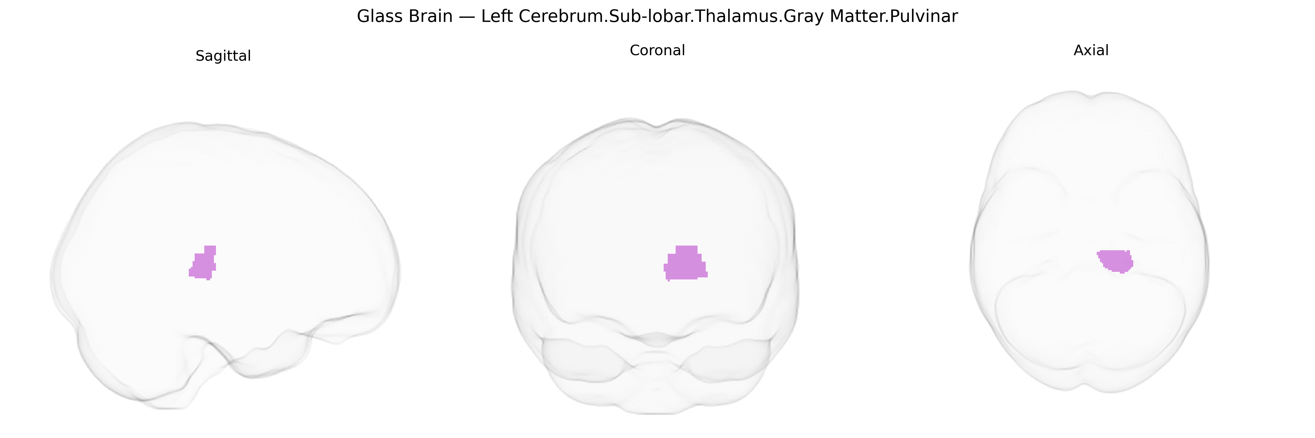 Triplanar Ghost Brain
