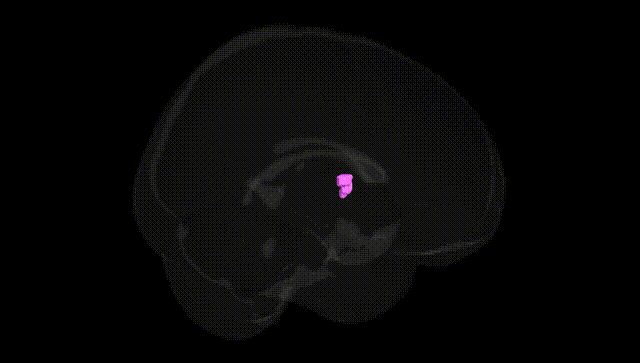 Full Brain Black