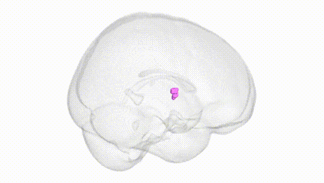 Full Brain White