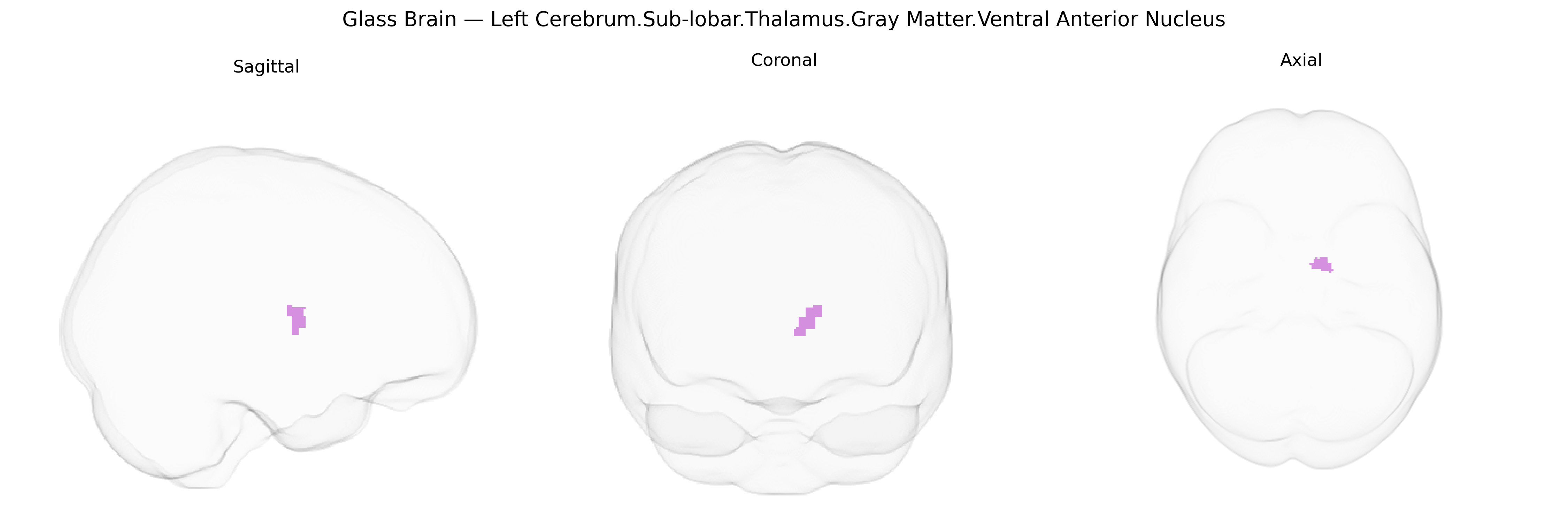 Triplanar Ghost Brain