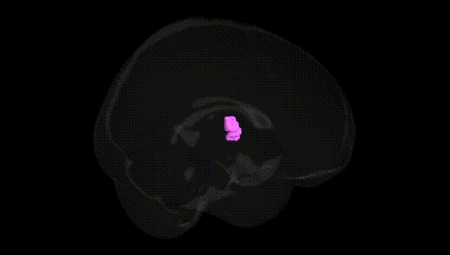 Full Brain Black