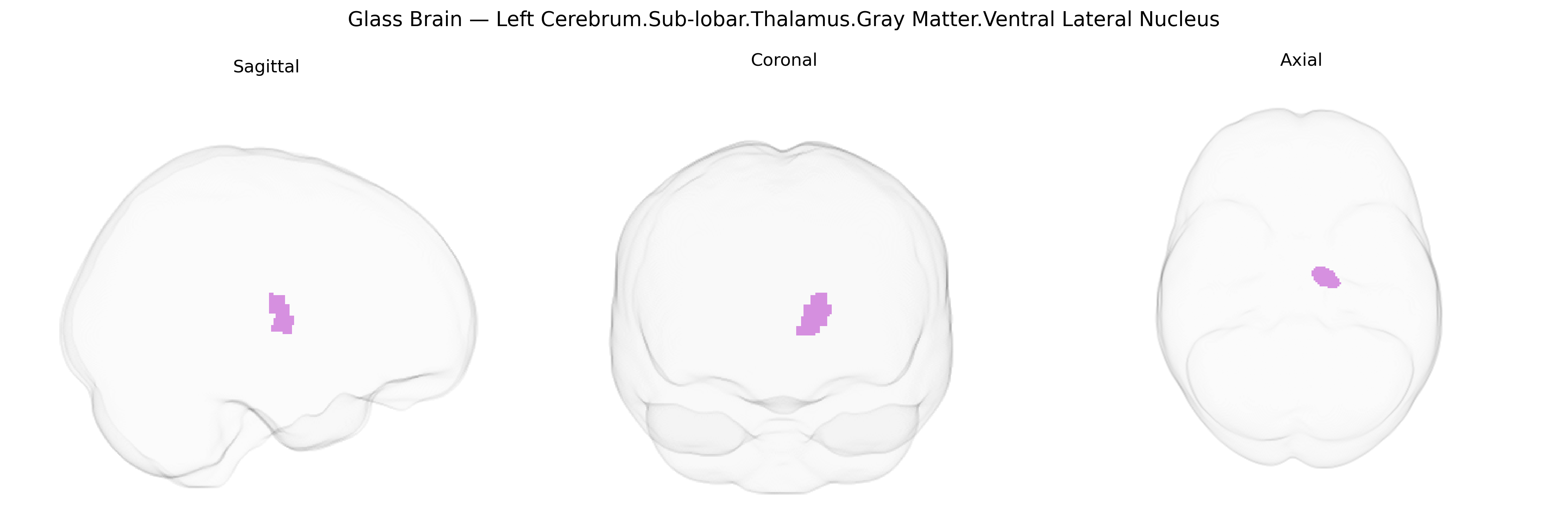 Triplanar Ghost Brain