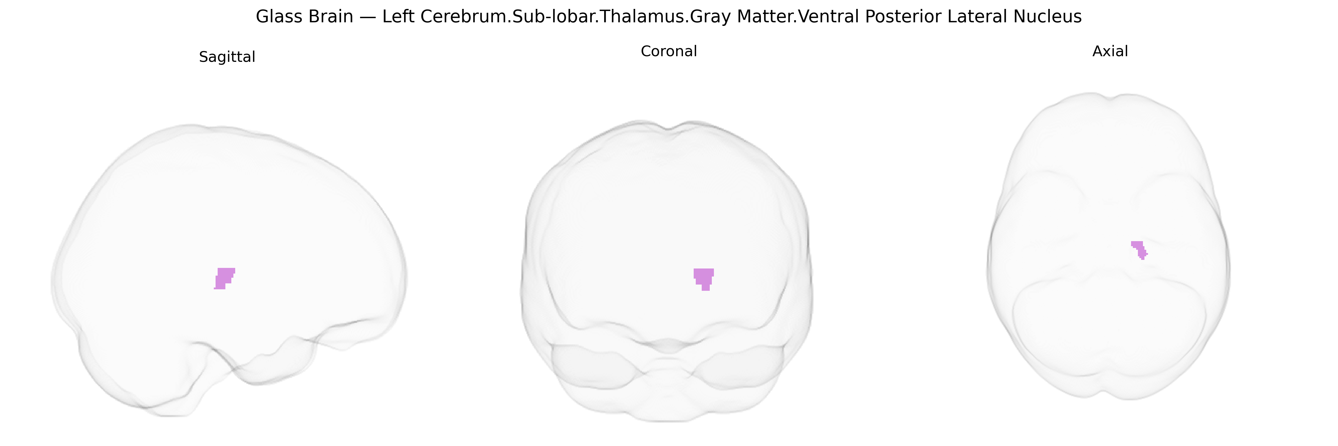 Triplanar Ghost Brain