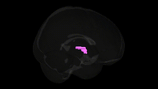 Full Brain Black