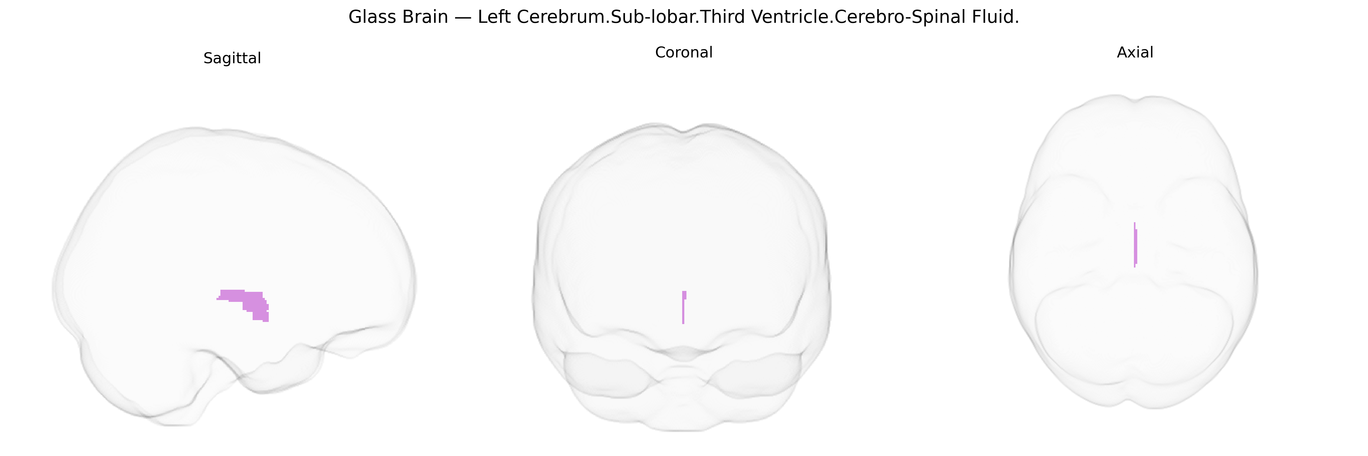 Triplanar Ghost Brain