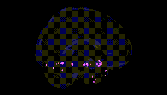 Full Brain Black