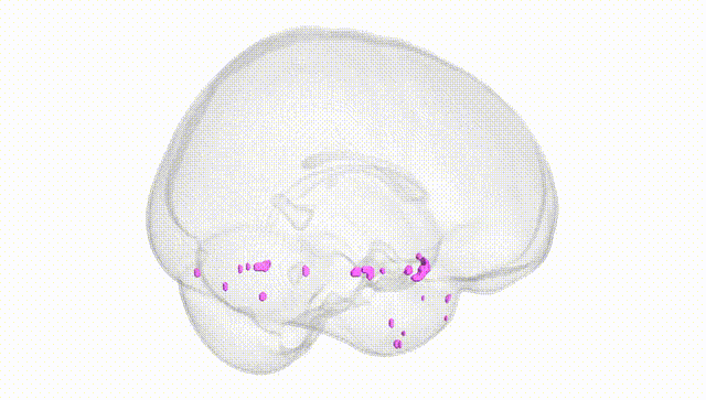 Full Brain White