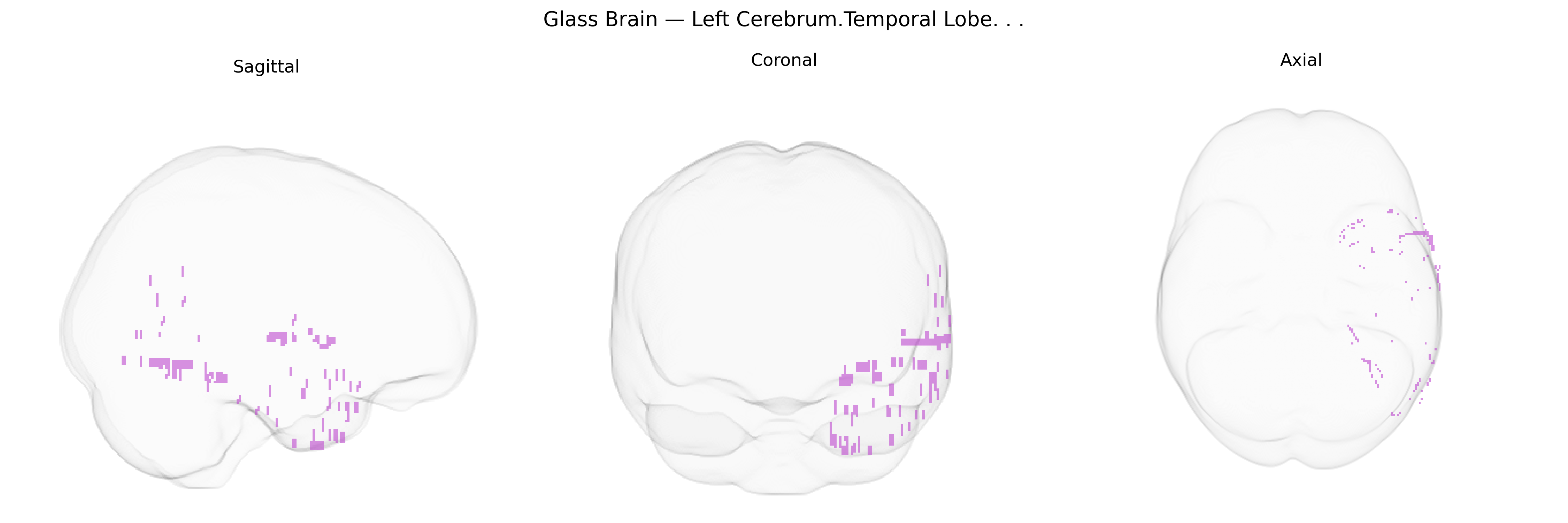 Triplanar Ghost Brain