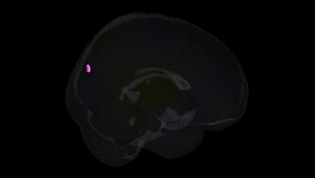 Full Brain Black
