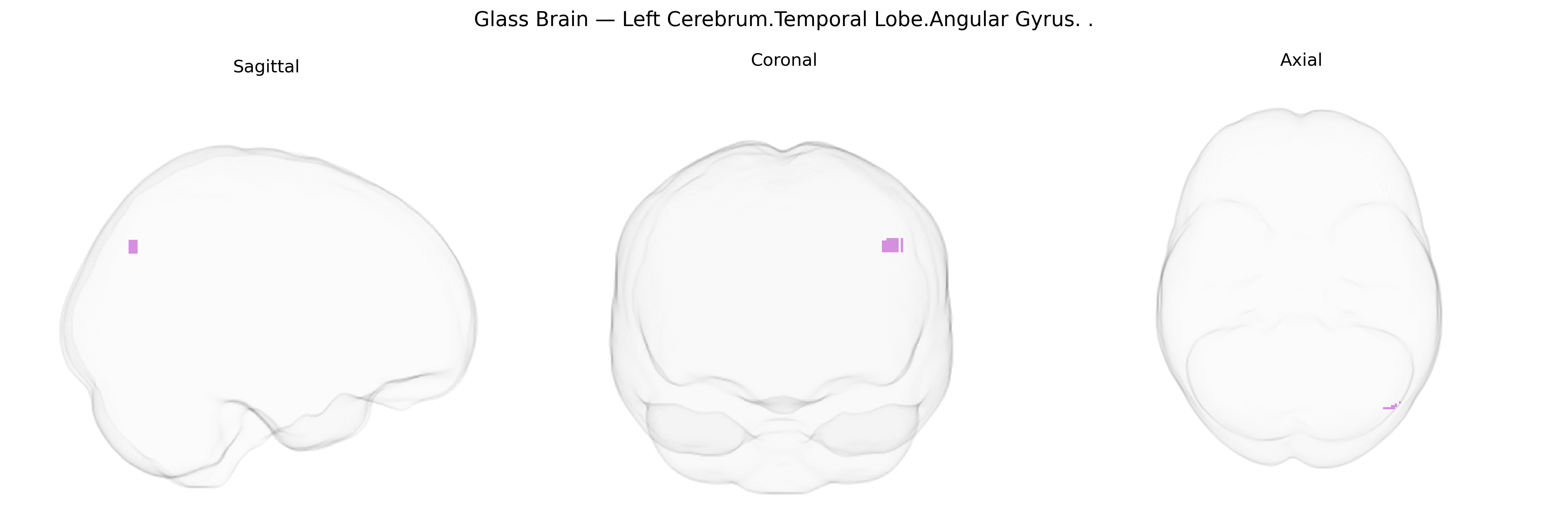 Triplanar Ghost Brain