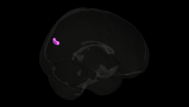 Full Brain Black
