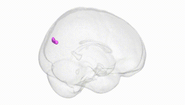 Full Brain White