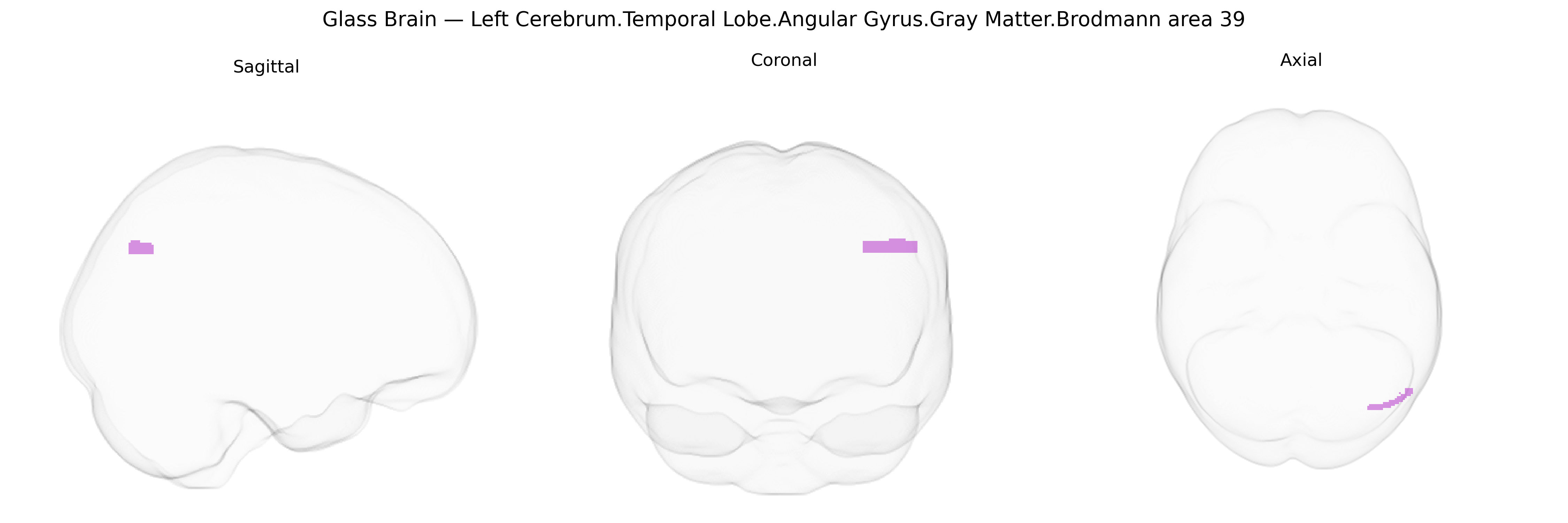 Triplanar Ghost Brain