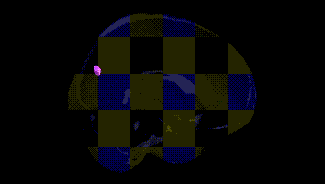 Full Brain Black