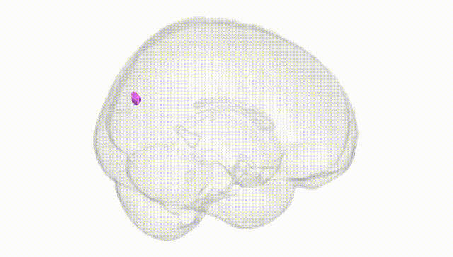Full Brain White