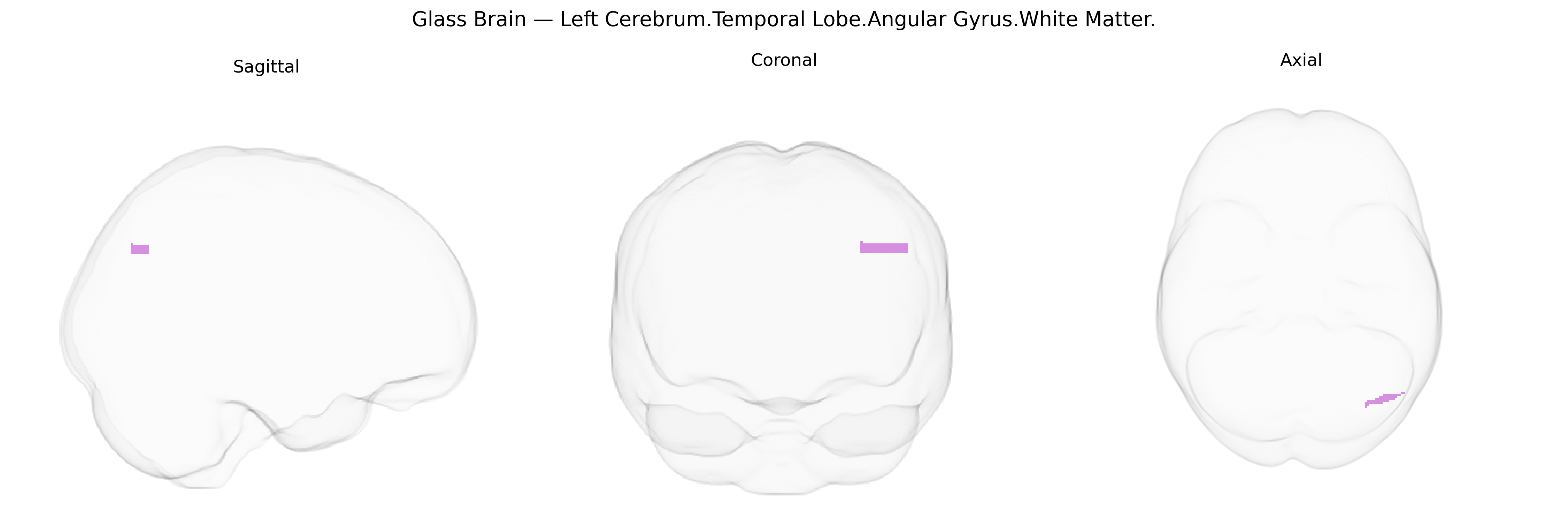 Triplanar Ghost Brain