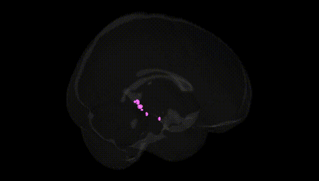 Full Brain Black
