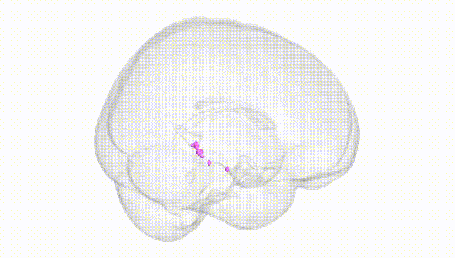 Full Brain White