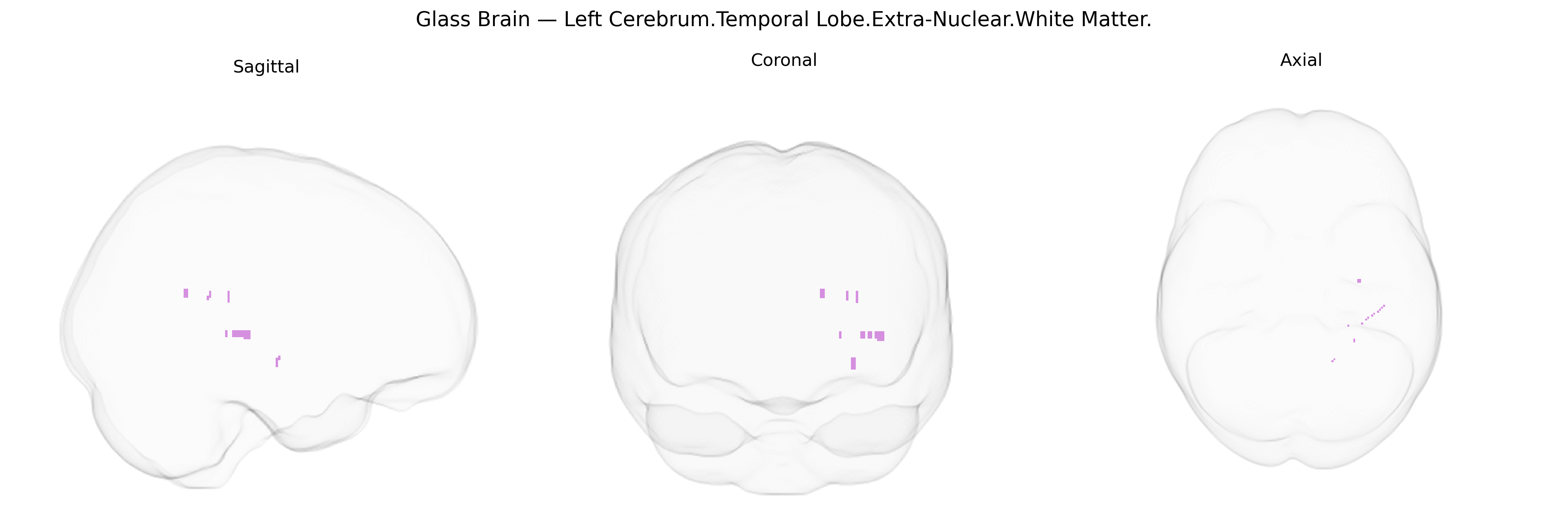 Triplanar Ghost Brain