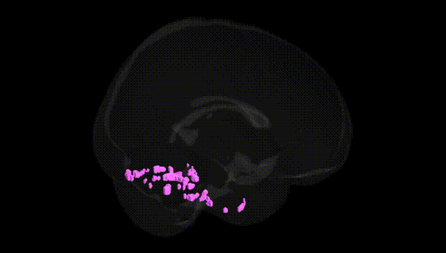Full Brain Black