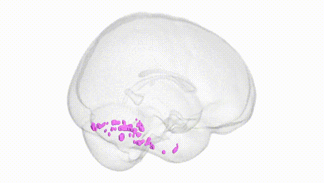 Full Brain White