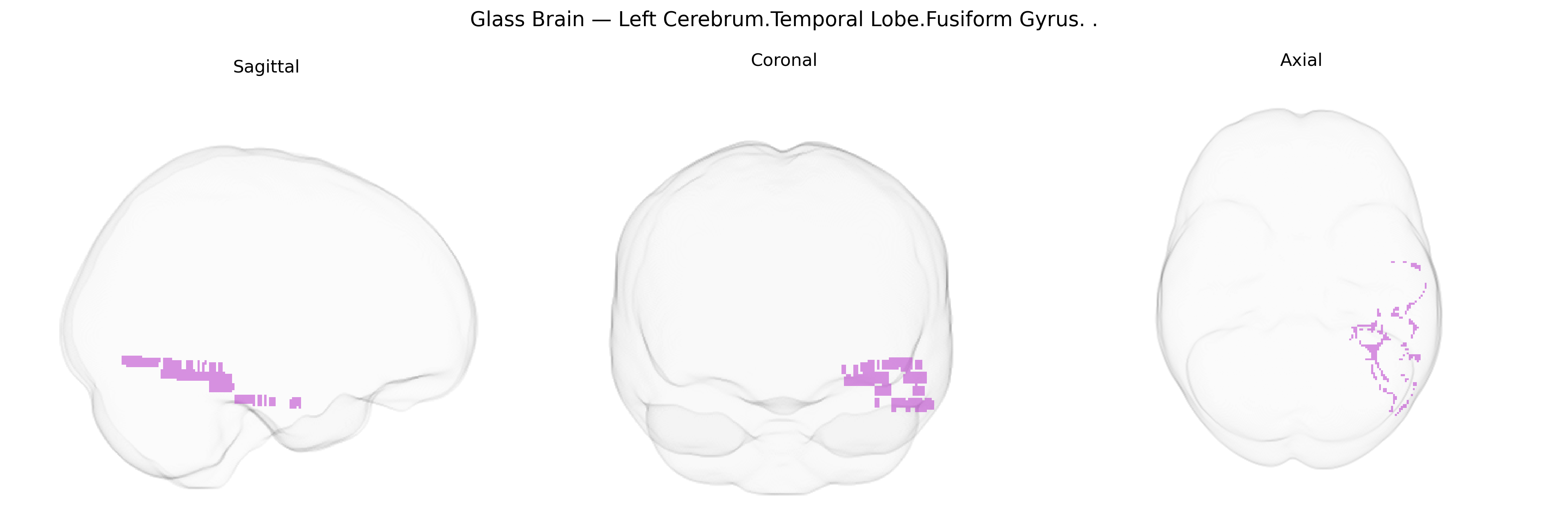 Triplanar Ghost Brain