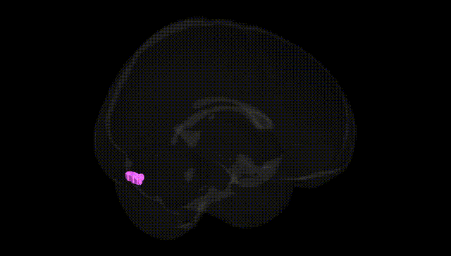 Full Brain Black
