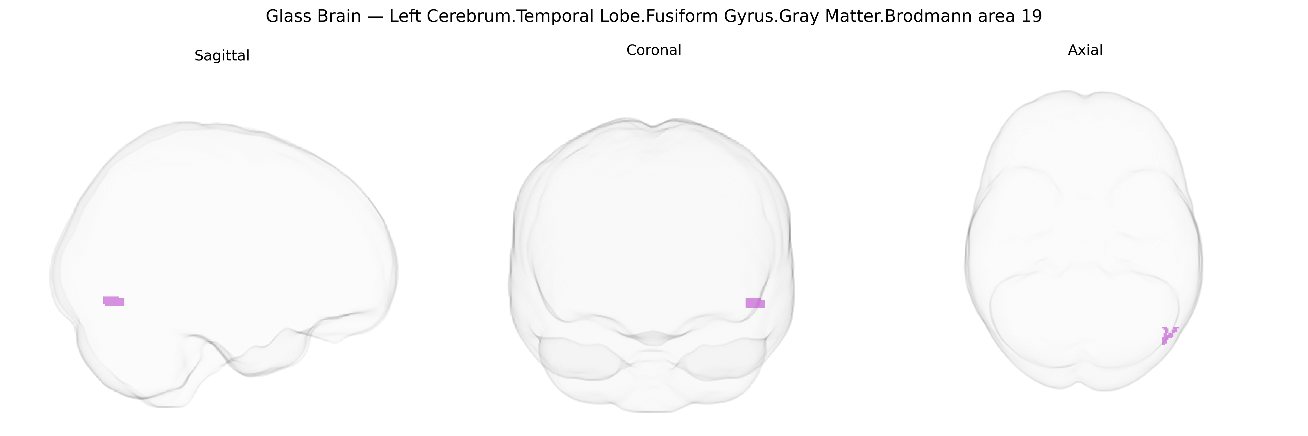 Triplanar Ghost Brain