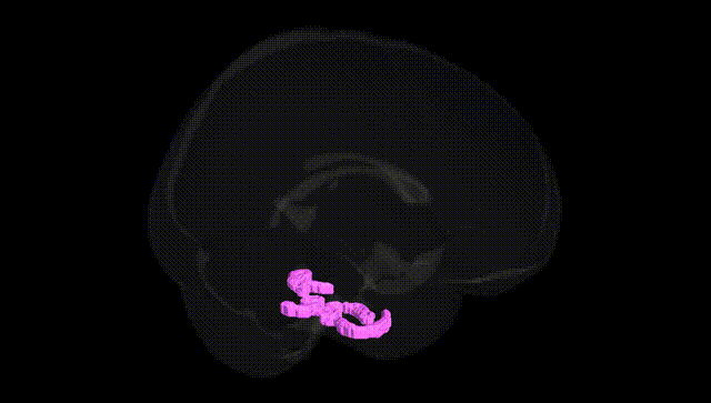 Full Brain Black